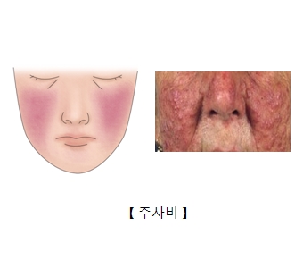 코고 이미지