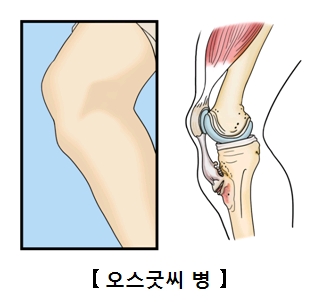 씨와 이미지
