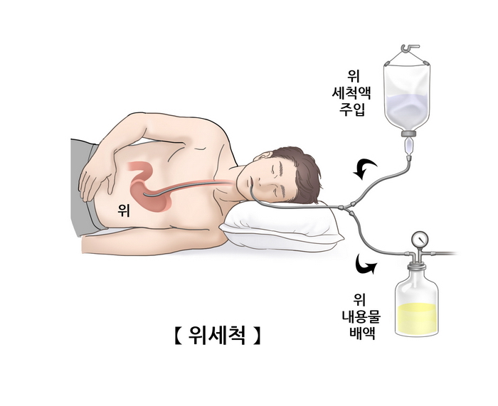 위 이미지
