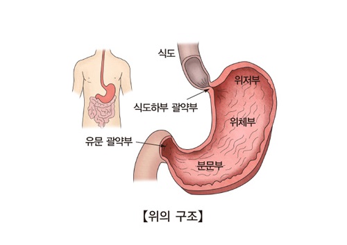 위 이미지