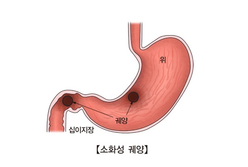 위 이미지