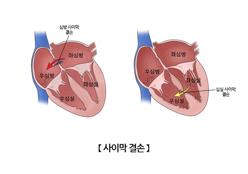 막# 이미지