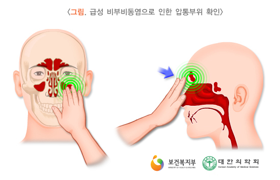 코고 이미지