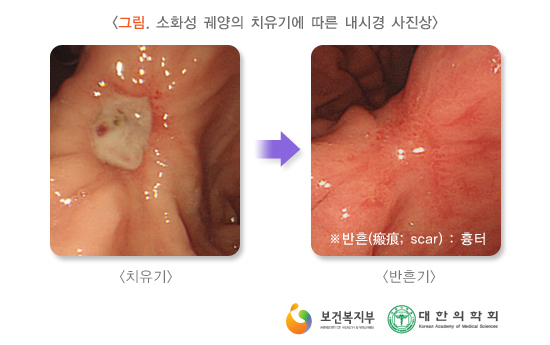위 이미지