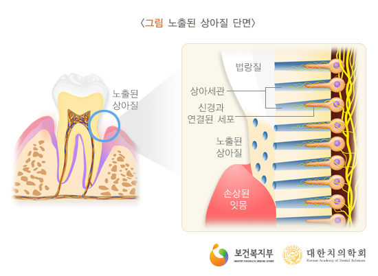 이라면 이미지
