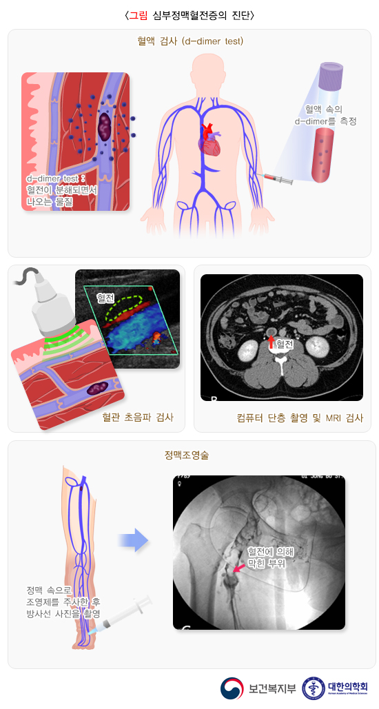 심 이미지