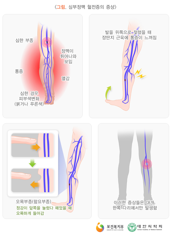 심 이미지