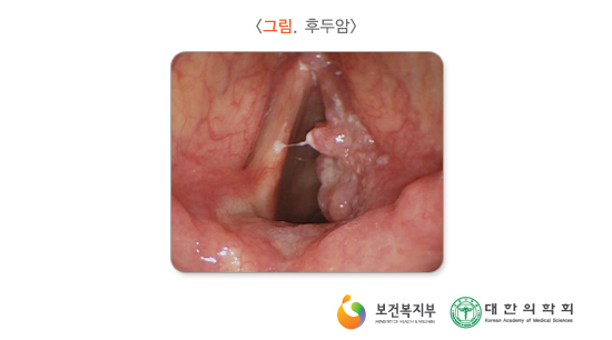 쉼 이미지