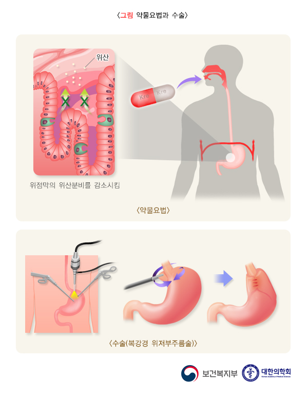 위 이미지