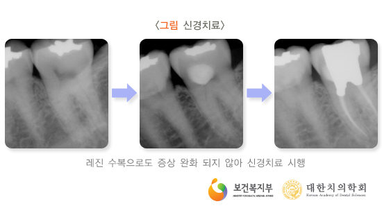 이라면 이미지