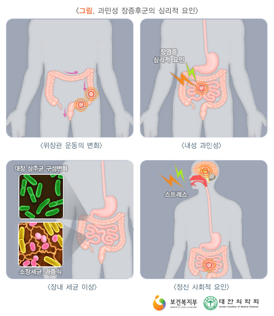 장 이미지
