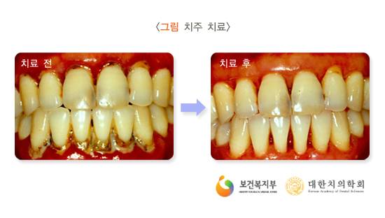 이라고 이미지