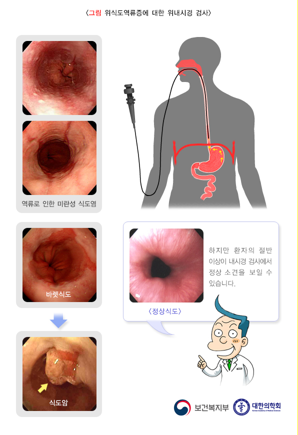 위 이미지
