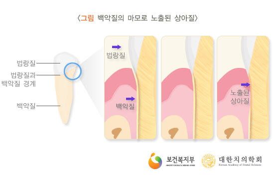 이라면 이미지