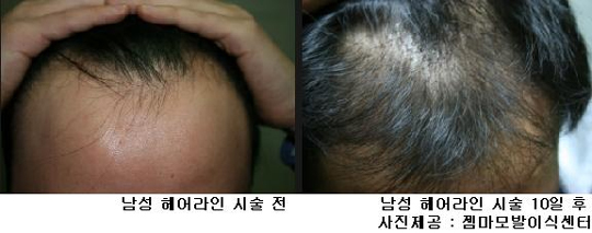 아름다운헤어 이미지