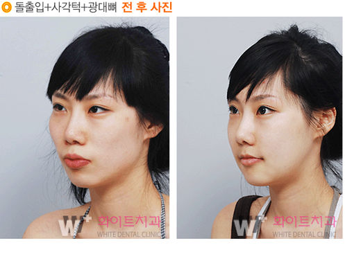 유(有) 이미지