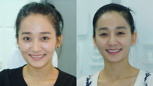 행복한부부치과 이미지