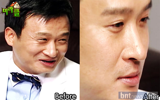 코어디 이미지