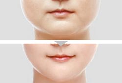 소망디자인 이미지