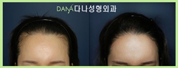 박재현헤어 이미지