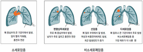 이레사 이미지