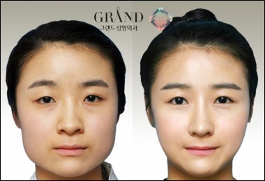 아로미라인 이미지