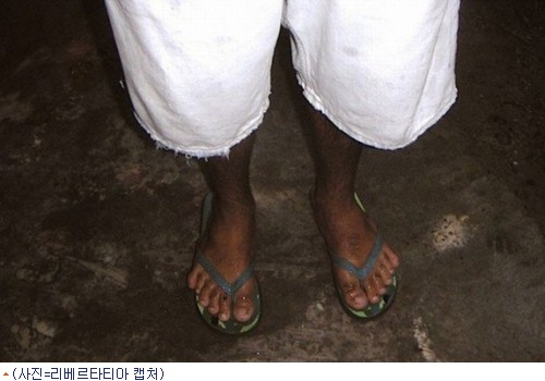 손가락발가락 이미지