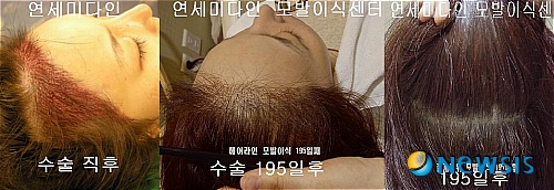 미다인헤어 이미지