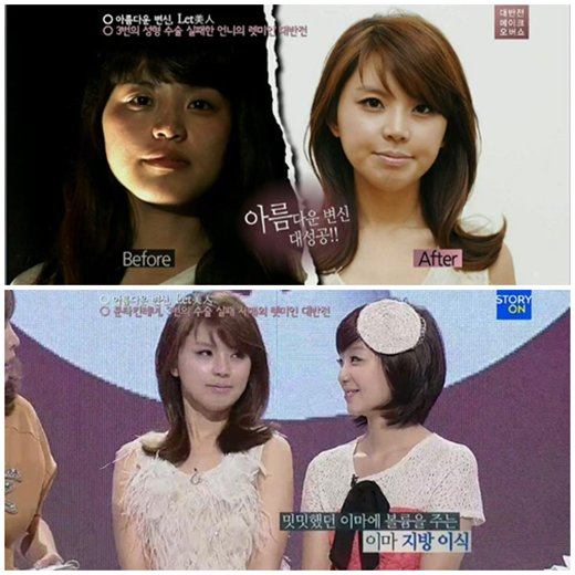 렛미인 이미지