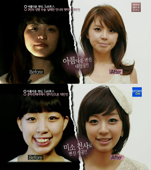 렛미인 이미지
