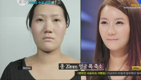 렛미인 이미지