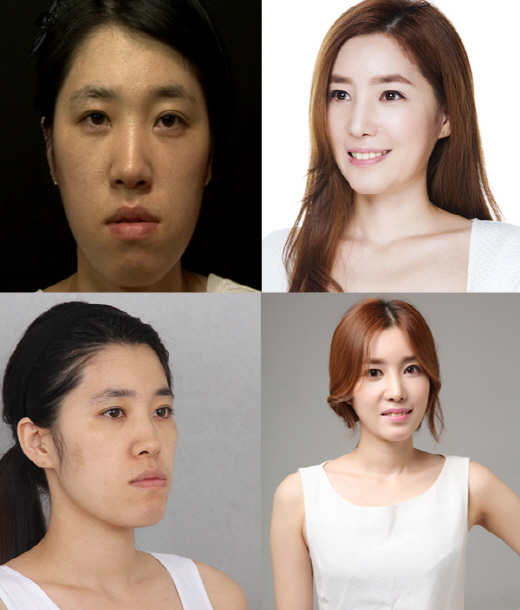 렛미인 이미지