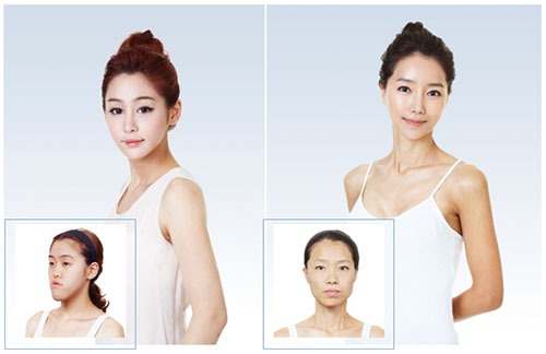 렛미인 이미지