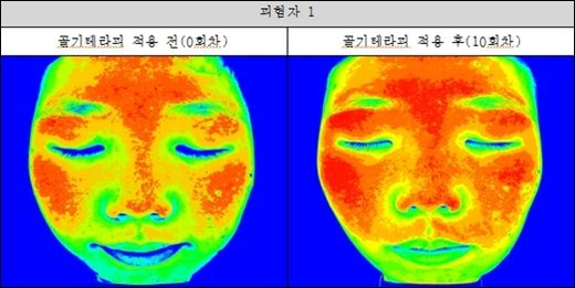 명가테라피 이미지