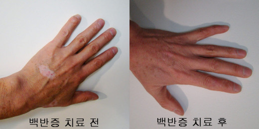 우보한의원 이미지