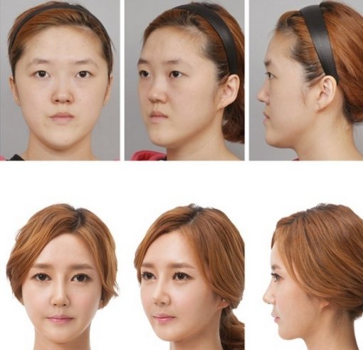 렛미인 이미지