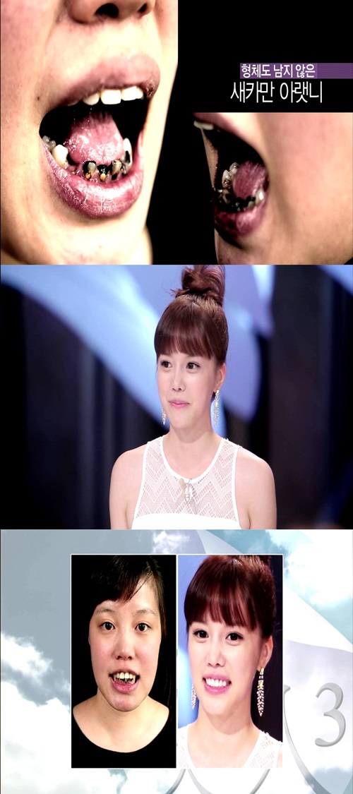 렛미인 이미지