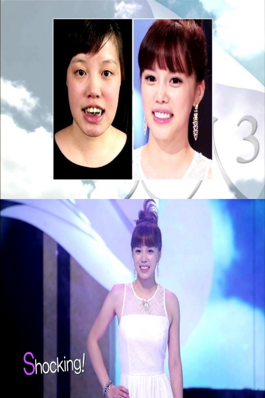 렛미인 이미지