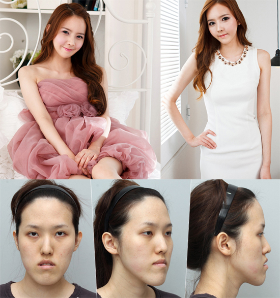 렛미인피부 이미지