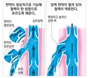 멋다리 이미지