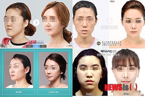 신데렐라성형외과의원 이미지