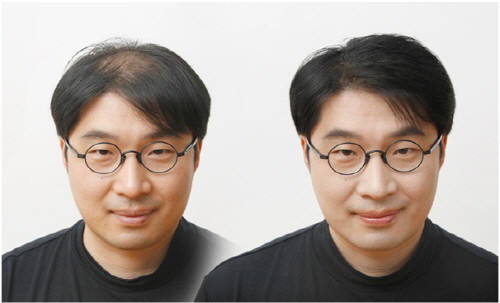 발머스한의원 이미지