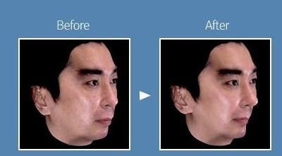 김정남 댄스 이미지