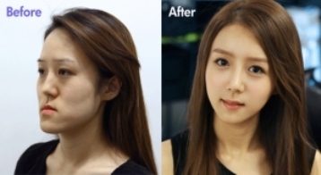 렛미인 이미지