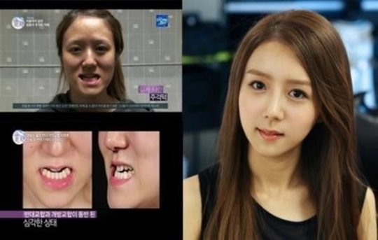 렛미인 이미지
