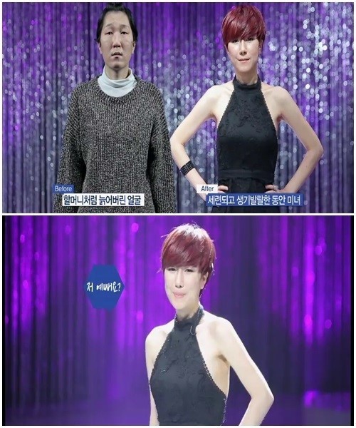 렛미인피부 이미지