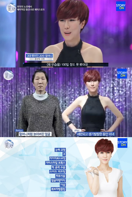렛미인피부 이미지