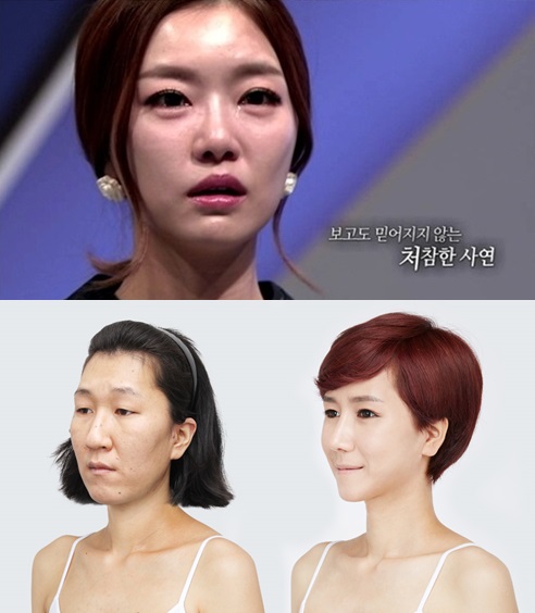 시크리젠 이미지