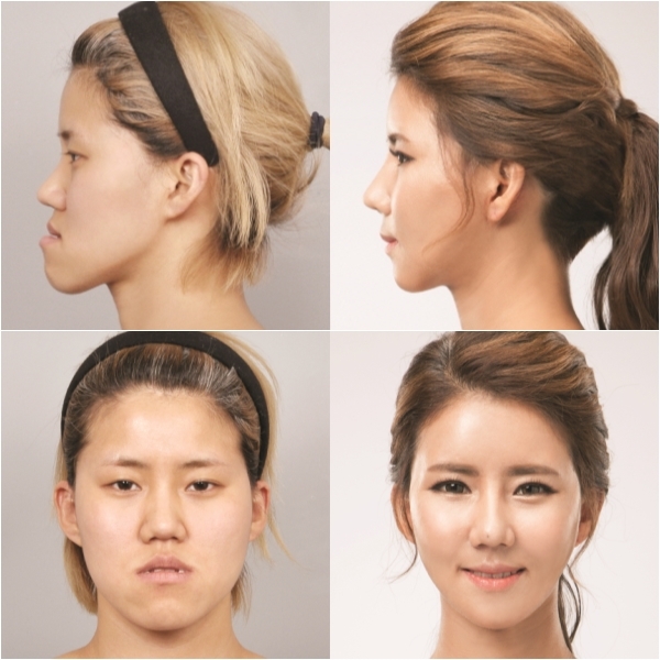 렛미인 이미지