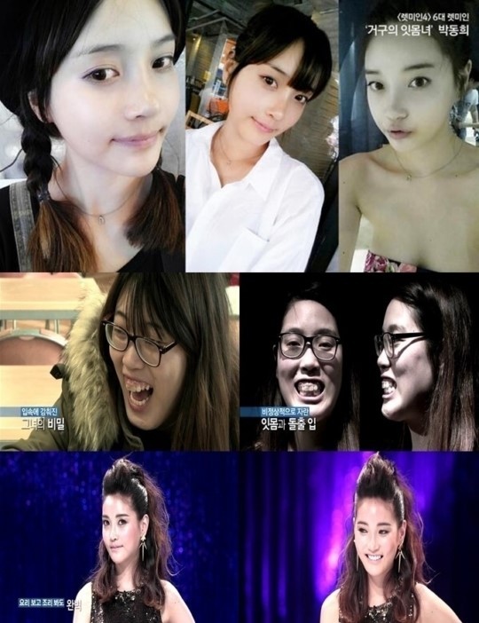 렛미인피부 이미지